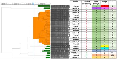 Investigation of a linezolid-resistant Staphylococcus epidermidis outbreak in a French hospital: phenotypic, genotypic, and clinical characterization